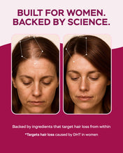 Load image into Gallery viewer, Improved Complex Saw Palmetto for Women 900 mg
